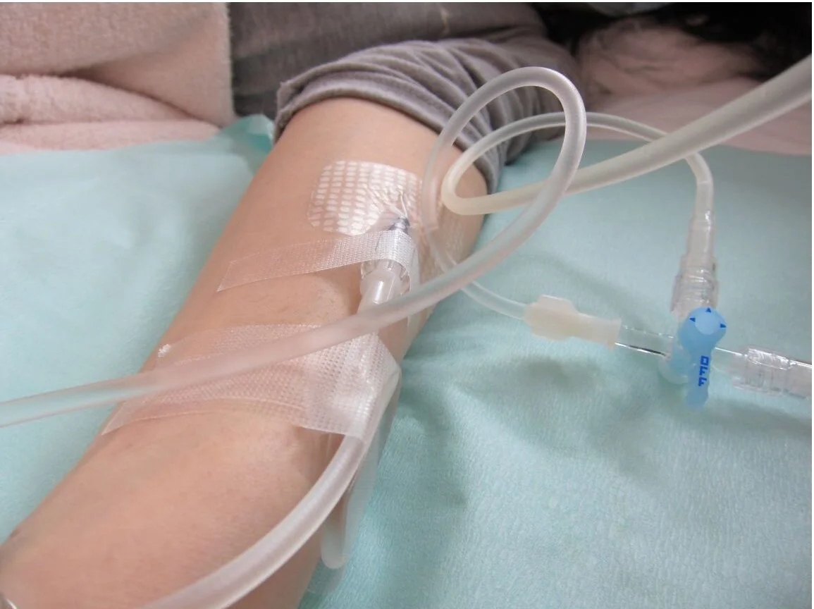 Thérapie Intraveineuse