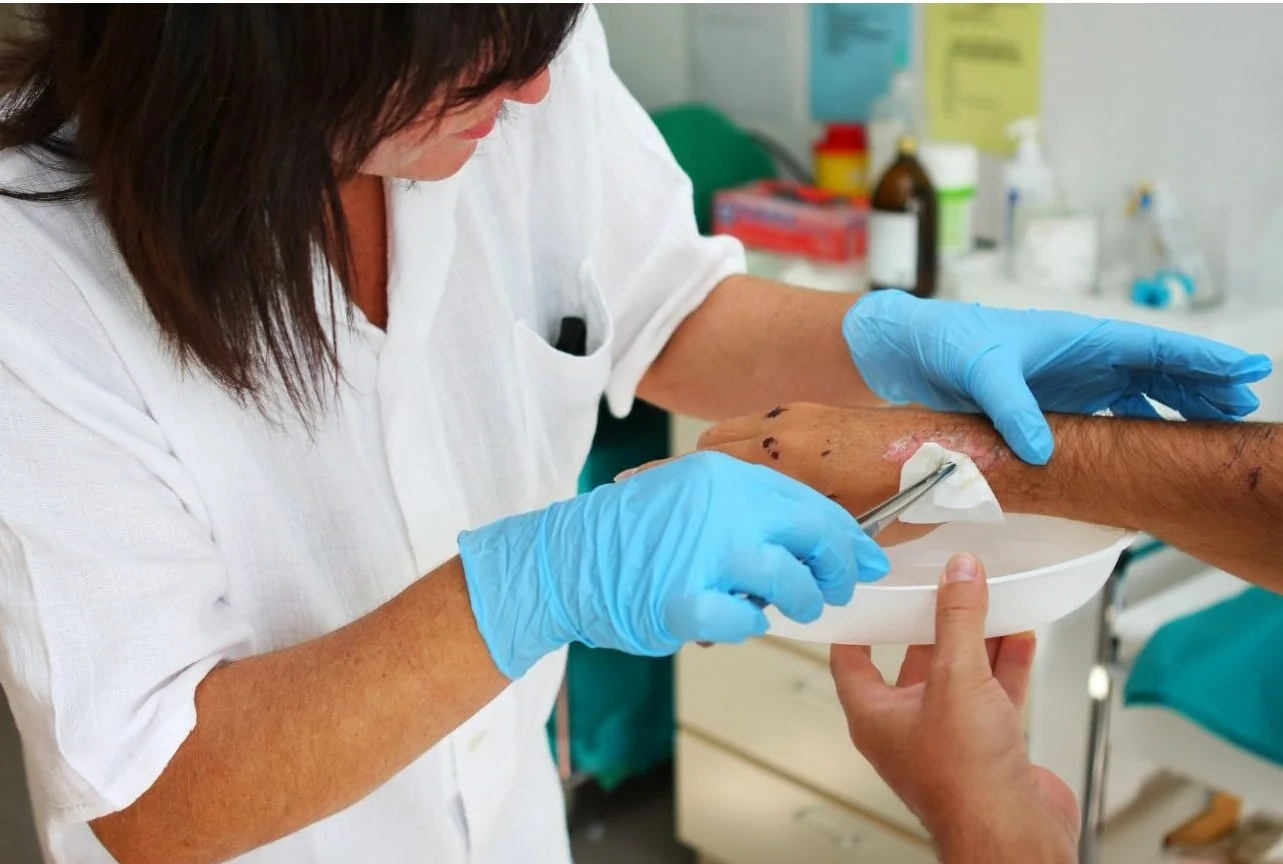 Soins liés aux traitements des plaies Traitement Plaies